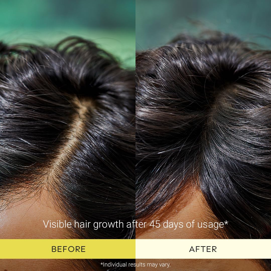 Turmeric Hair Oil